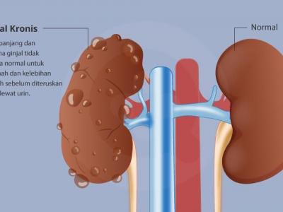 Diabetes dan Kerusakan Ginjal Kronis